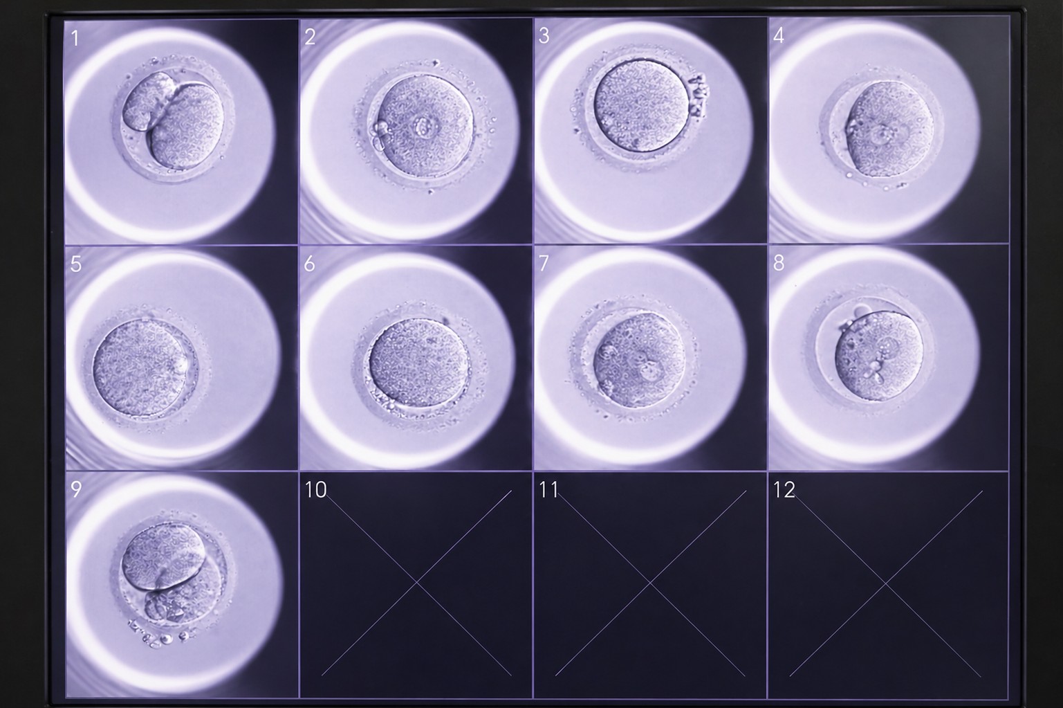 Embryo quality
