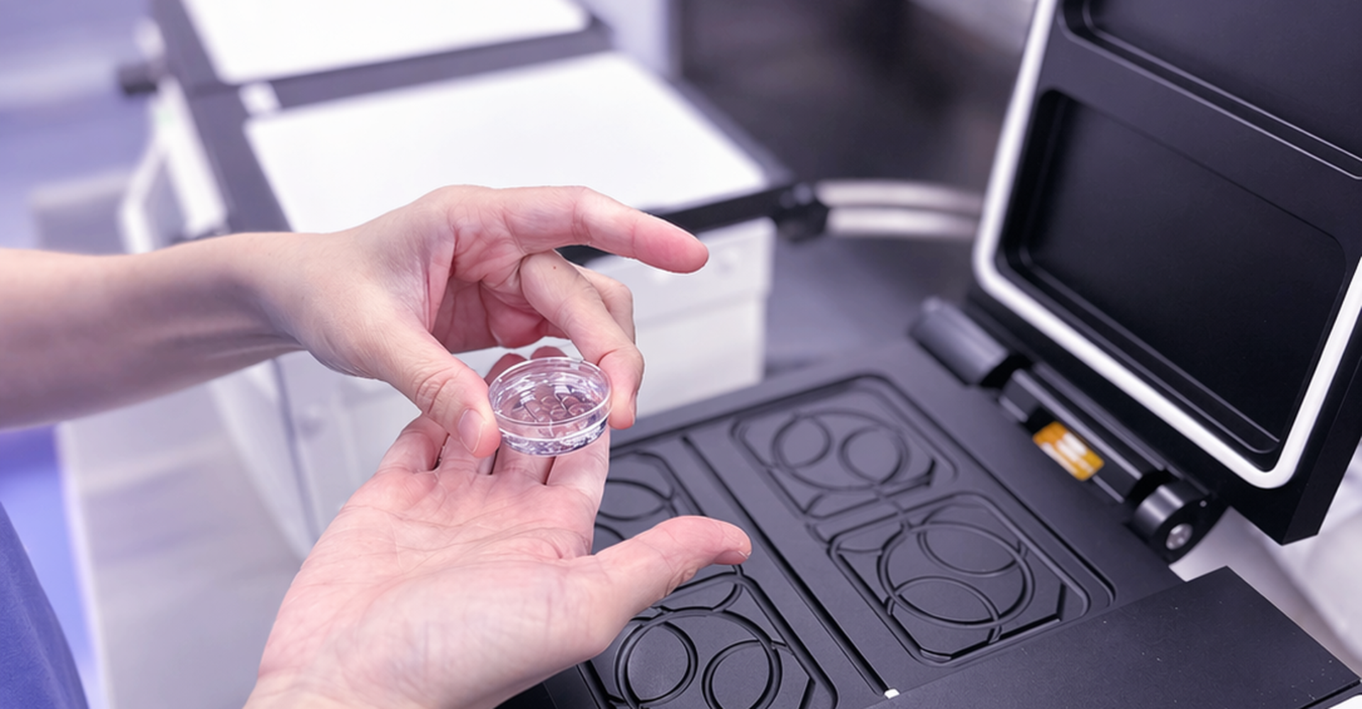Repeated IVF failure