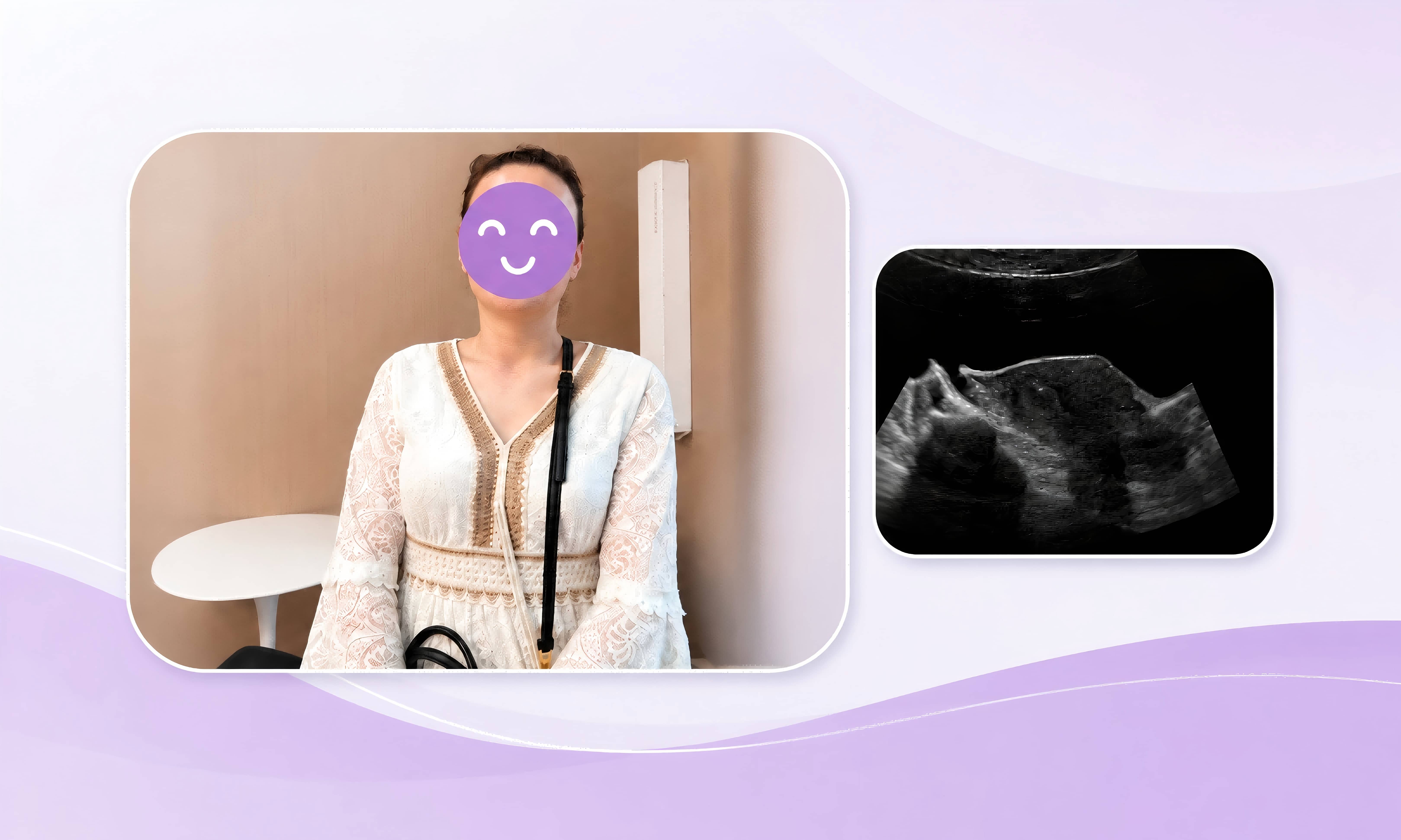 Embrvo Transfer Day | IRMC